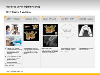 Public. © Carestream Health, 2016
Prosthetic-Driven Implant Planning
How Does It Works?
SCAN PATIENT MERGE DATA PLAN IMPLANT EXPORT DATA CREATE GUIDE
▪ Produce guide with the third
party of your choice
▪ Export 3D data into third party
implant software for surgical
guide creation
THIRD PARTY
SOFTWARE
1 2 3 4 5
▪ Add a virtual crown
▪ Plan the implant and abutment
taking into account the form and
location of final restoration
A. Take 3D X-ray scan with a
Carestream Dental CBCT unit
to evaluate bone structure
and identify anatomical
obstacles
B. Use the CS 3500 / CS 3600
intraoral scanner to obtain
digital impressions
or
Scan the traditional
impression using a Carestream
Dental CBCT unit
▪ Digital impression and CBCT
scan are merged automatically
in CS 3D Imaging software
▪ Adjust manually the merge if
needed
 