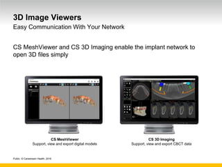 Public. © Carestream Health, 2016
3D Image Viewers
CS MeshViewer and CS 3D Imaging enable the implant network to
open 3D files simply
Easy Communication With Your Network
CS MeshViewer
Support, view and export digital models
CS 3D Imaging
Support, view and export CBCT data
 