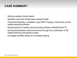 Public. © Carestream Health, 2016
CASE SUMMARY
• Missing maxillary incisor lateral
• Aesthetic zone with limited space between teeth
• Treatment feasibility is validated using CBCT imaging, virtual tooth and 3D
implant planning software
• Surgical guide is created using third party software (NobelClinicianTM)
• Successful prosthetic outcome achieved through the combination of 3D
implant planning and guided surgery
• Full digital workflow allows for immediate loading
 