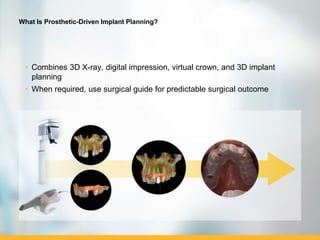 Public. © Carestream Health, 2016
What Is Prosthetic-Driven Implant Planning?
• Combines 3D X-ray, digital impression, virtual crown, and 3D implant
planning
• When required, use surgical guide for predictable surgical outcome
 