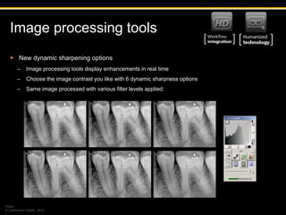 The RVG 5200 From Carestream Dental. Digital Xray Sensor System. | PPTX
