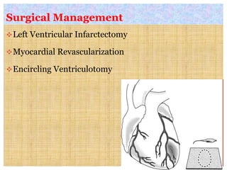 Surgical Management
Left Ventricular Infarctectomy
Myocardial Revascularization
Encircling Ventriculotomy
 