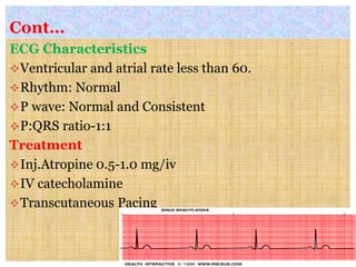 Cont…
ECG Characteristics
Ventricular and atrial rate less than 60.
Rhythm: Normal
P wave: Normal and Consistent
P:QRS ratio-1:1
Treatment
Inj.Atropine 0.5-1.0 mg/iv
IV catecholamine
Transcutaneous Pacing
 