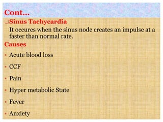 Cont…
Sinus Tachycardia
It occures when the sinus node creates an impulse at a
faster than normal rate.
Causes
 Acute blood loss
 CCF
 Pain
 Hyper metabolic State
 Fever
 Anxiety
 