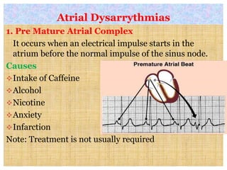 Atrial Dysarrythmias
1. Pre Mature Atrial Complex
It occurs when an electrical impulse starts in the
atrium before the normal impulse of the sinus node.
Causes
Intake of Caffeine
Alcohol
Nicotine
Anxiety
Infarction
Note: Treatment is not usually required
 