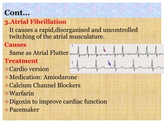 Cont…
3.Atrial Fibrillation
It causes a rapid,disorganised and uncontrolled
twitching of the atrial musculature.
Causes
Same as Atrial Flutter
Treatment
Cardio version
Medication: Amiodarone
Calcium Channel Blockers
Warfarin
Digoxin to improve cardiac function
Pacemaker
 