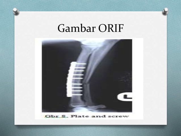 Oref Hardware 363736329-PERAWATAN-LUKA-ORIF-OREF-pptx.pptx
