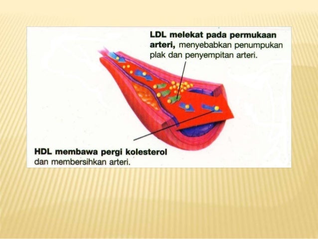 (364342723) penyakit jantung-koroner.ppt