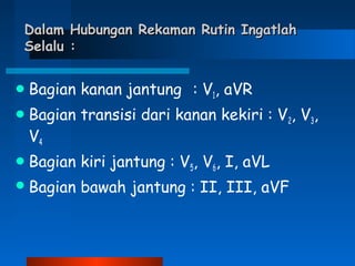 Dalam Hubungan Rekaman Rutin IngatlahDalam Hubungan Rekaman Rutin Ingatlah
Selalu :Selalu :
Bagian kanan jantung : V1, aVR
Bagian transisi dari kanan kekiri : V2, V3,
V4
Bagian kiri jantung : V5, V6, I, aVL
Bagian bawah jantung : II, III, aVF
 