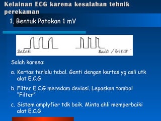 Kelainan ECG karena kesalahan tehnikKelainan ECG karena kesalahan tehnik
perekamanperekaman
1. Bentuk Patokan 1 mV
Salah karena:
a. Kertas terlalu tebal. Ganti dengan kertas yg asli utk
alat E.C.G
b. Filter E.C.G meredam deviasi. Lepaskan tombol
“Filter”
c. Sistem amplyfier tdk baik. Minta ahli memperbaiki
alat E.C.G
 