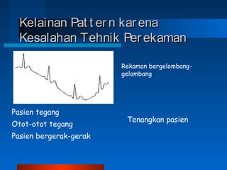 Kelainan Pat t ern karenaKelainan Pat t ern karena
Kesalahan Tehnik PerekamanKesalahan Tehnik Perekaman
Rekaman bergelombang-
gelombang
Pasien tegang
Otot-otot tegang
Pasien bergerak-gerak
Tenangkan pasien
 
