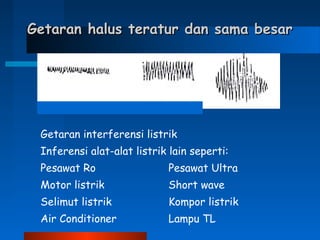 Getaran halus teratur dan sama besarGetaran halus teratur dan sama besar
Getaran interferensi listrik
Inferensi alat-alat listrik lain seperti:
Pesawat Ro Pesawat Ultra
Motor listrik Short wave
Selimut listrik Kompor listrik
Air Conditioner Lampu TL
 