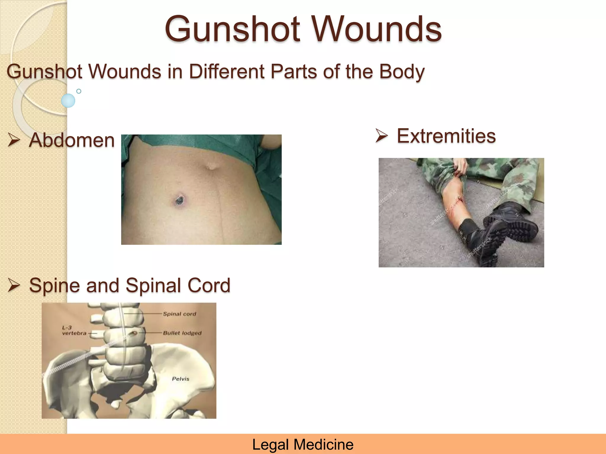 Berna Firearm Injuries 365619770-Legal-MEdicine.pptx