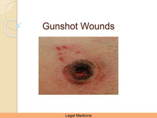 Gunshot Wounds
Legal Medicine
 