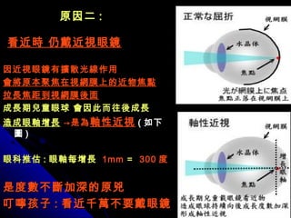 原因二原因二 ::
看近時 仍戴近視眼鏡看近時 仍戴近視眼鏡
因近視眼鏡有擴散光線作用因近視眼鏡有擴散光線作用
會將原本聚焦在視網膜上的近物焦點會將原本聚焦在視網膜上的近物焦點
拉長焦距到視網膜後面拉長焦距到視網膜後面
成長期兒童眼球 會因此而往後成長成長期兒童眼球 會因此而往後成長
造成眼軸增長造成眼軸增長 →是為→是為軸性近視軸性近視 (( 如下如下
圖圖 ))
眼科推估眼科推估 :: 眼軸每增長眼軸每增長 1mm1mm == 300300 度度
是度數不斷加深的原兇是度數不斷加深的原兇
叮嚀孩子叮嚀孩子 :: 看近千萬不要戴眼鏡看近千萬不要戴眼鏡
 