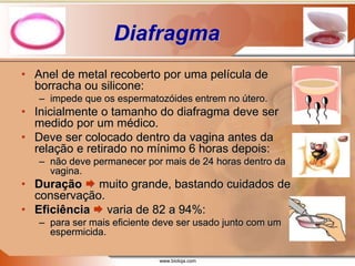 www.bioloja.com
Diafragma
• Anel de metal recoberto por uma película de
borracha ou silicone:
– impede que os espermatozóides entrem no útero.
• Inicialmente o tamanho do diafragma deve ser
medido por um médico.
• Deve ser colocado dentro da vagina antes da
relação e retirado no mínimo 6 horas depois:
– não deve permanecer por mais de 24 horas dentro da
vagina.
• Duração  muito grande, bastando cuidados de
conservação.
• Eficiência  varia de 82 a 94%:
– para ser mais eficiente deve ser usado junto com um
espermicida.
 