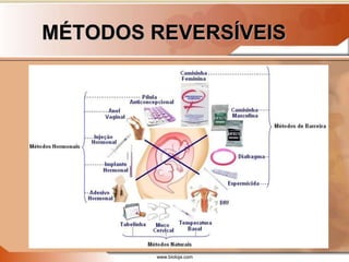 www.bioloja.com
MÉTODOS REVERSÍVEIS
 
