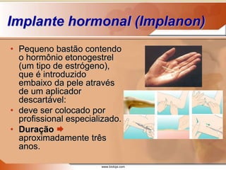 www.bioloja.com
Implante hormonal (Implanon)
• Pequeno bastão contendo
o hormônio etonogestrel
(um tipo de estrógeno),
que é introduzido
embaixo da pele através
de um aplicador
descartável:
• deve ser colocado por
profissional especializado.
• Duração 
aproximadamente três
anos.
 