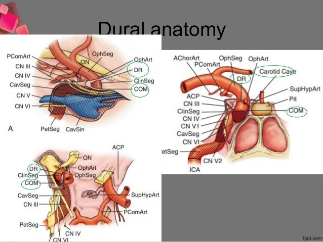 366 Microsurgery of paraclinoid aneurysm