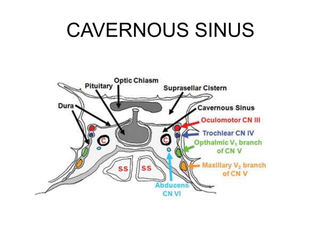 367014512-3-4-6-CRANIAL-NERVES-ppt.ppt | Eye and Vision Conditions ...