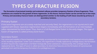 General Medicine, General Surgery. Fractures | PPTX
