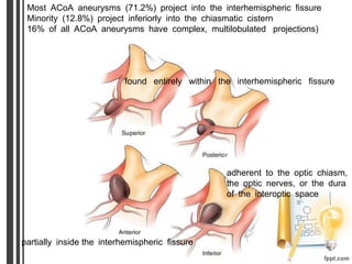 Most ACoA aneurysms (71.2%) project into the interhemispheric fissure
Minority (12.8%) project inferiorly into the chiasmatic cistern
16% of all ACoA aneurysms have complex, multilobulated projections)
found entirely within the interhemispheric fissure
partially inside the interhemispheric fissure
adherent to the optic chiasm,
the optic nerves, or the dura
of the interoptic space
 