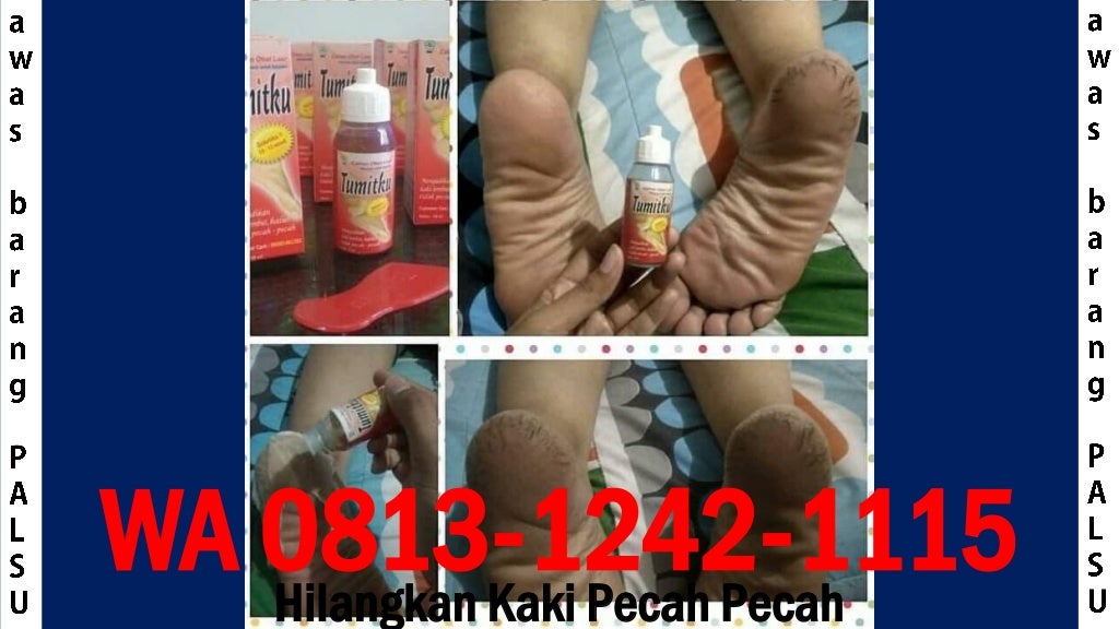 Cara Mengobati Kaki Pecah Pecah Cara Mengobati Kaki Pecah Pecah
