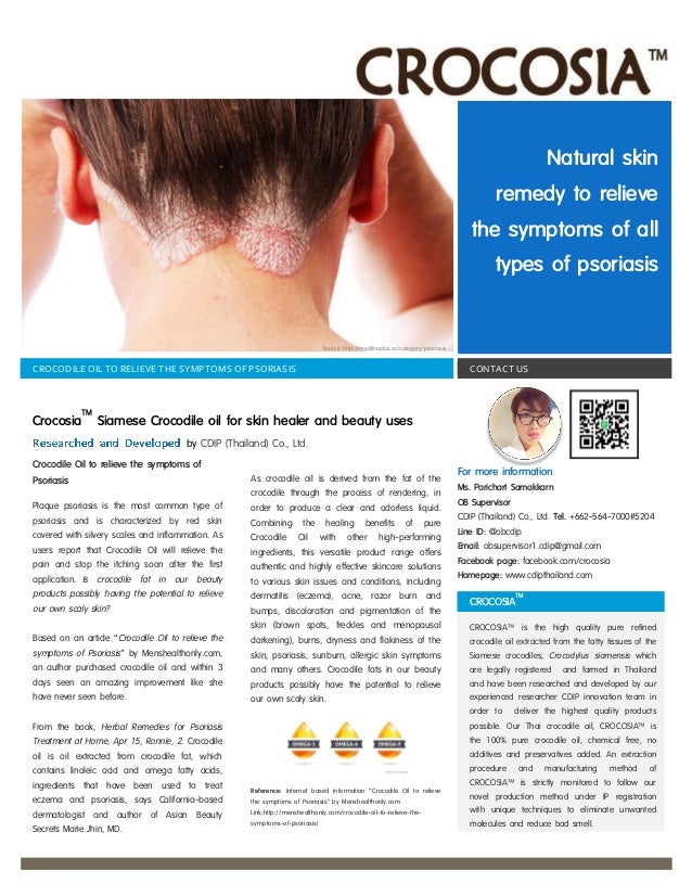 crocodile oil for stretch marks