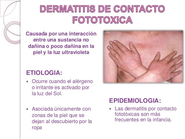 Si es posible dar la sangre si estás enfermo de la psoriasis