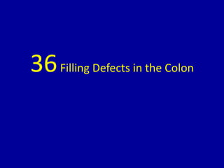 36Filling Defects in the Colon
 