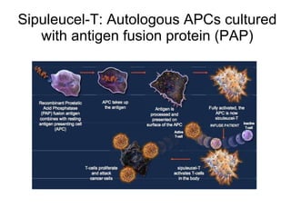 Sipuleucel-T: Autologous APCs cultured with antigen fusion protein (PAP) 