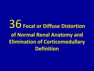 36Focal or Diffuse Distortion
of Normal Renal Anatomy and
Elimination of Corticomedullary
Definition
 