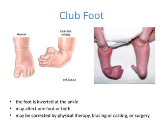 anatomy of Congenital Abnormalities.pptx