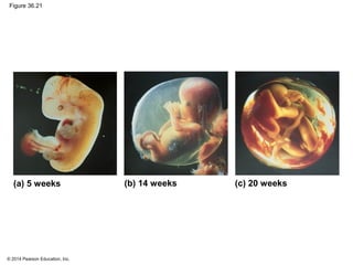 © 2014 Pearson Education, Inc.
Figure 36.21
(a) 5 weeks (c) 20 weeks(b) 14 weeks
 
