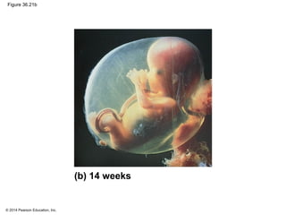 © 2014 Pearson Education, Inc.
Figure 36.21b
(b) 14 weeks
 