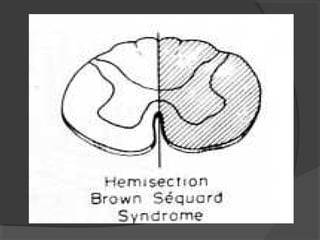 37.motoneurona superior e_inferior