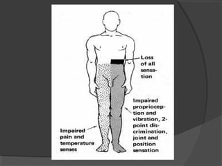 37.motoneurona superior e_inferior