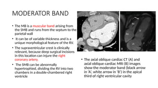 37.imaging of cardiac anatomy and pericardium.pptx