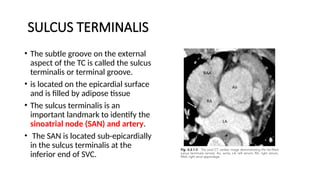 37.imaging of cardiac anatomy and pericardium.pptx