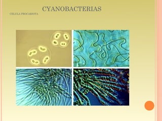 CYANOBACTERIAS
CELULA PROCARIOTA
 
