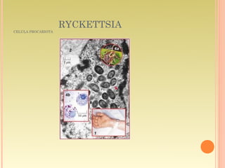 RYCKETTSIA
CELULA PROCARIOTA
 