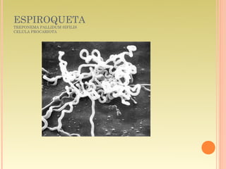 ESPIROQUETA
TREPONEMA PALLIDUM SIFILIS
CELULA PROCARIOTA
 