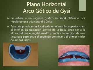 Plano Horizontal
Arco Gótico de Gysi
 Se refiere a un registro grafico intraoral obtenido por
medio de una púa central y única.
 Esta púa puede estar localizada en el maxilar superior o en
el inferior. Su ubicación dentro de la boca debe ser a la
altura del plano sagital medio y en la intersección de una
línea que pase entre el segundo premolar y el primer molar
de ambos lados.
 
