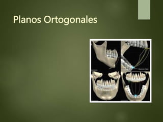 Planos Ortogonales
 