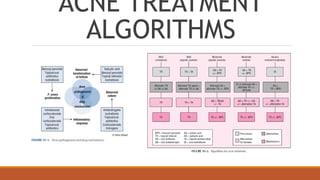 Pimple Algorithm Acne vulgaris-acne vulgaris - acne vulgaris | PPTX