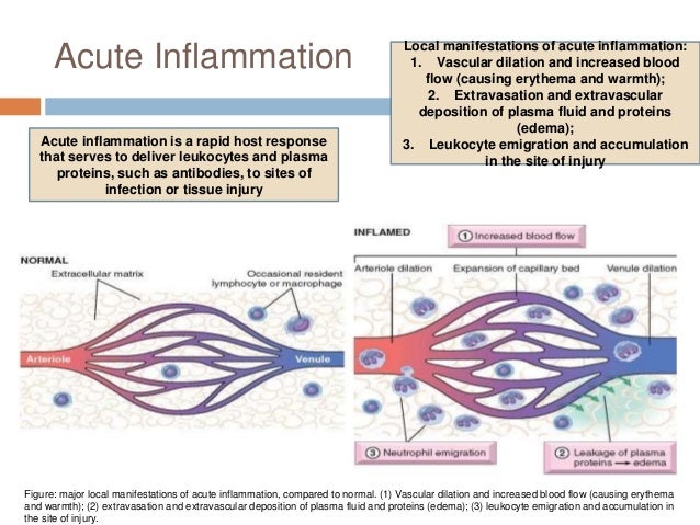 Inflammation and repair