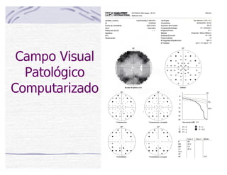 Campo Visual
Patológico
Computarizado
