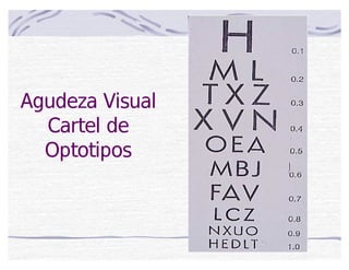 Agudeza Visual
Cartel de
Optotipos