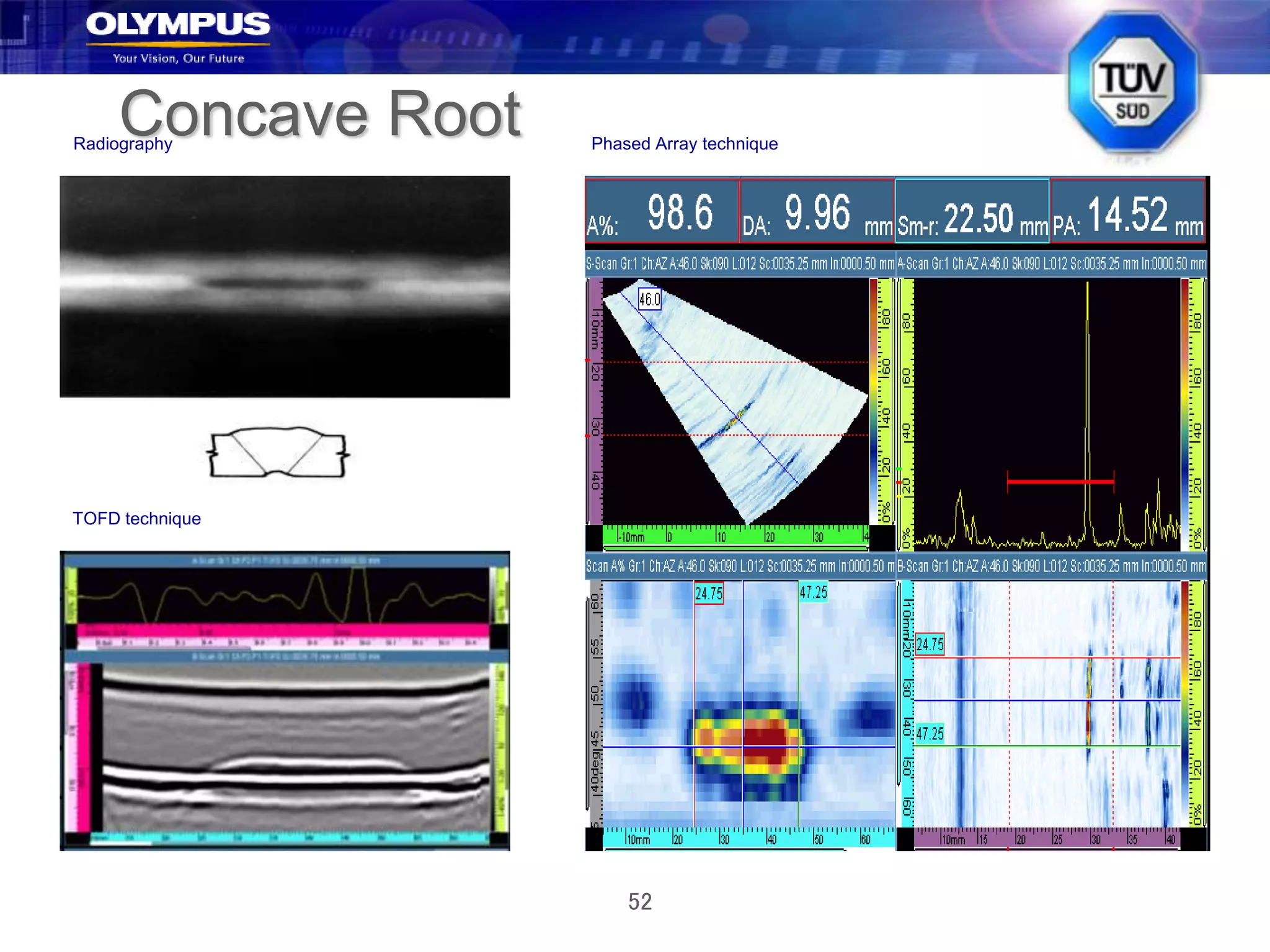 52
Concave Root
TOFD technique
Radiography Phased Array technique
 