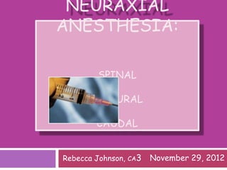 NEURAXIAL
ANESTHESIA:
SPINAL
EPIDURAL
CAUDAL
Rebecca Johnson, CA3 November 29, 2012
 